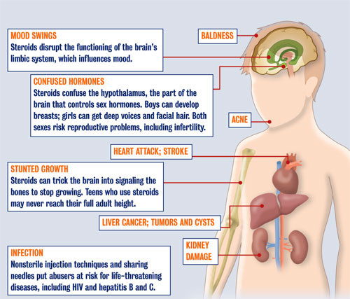 Facts You Must Know About Steroids