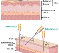 hgh injection zone
