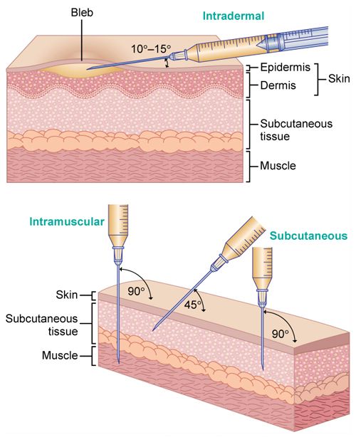 Injection Zones And Techniques For HGH